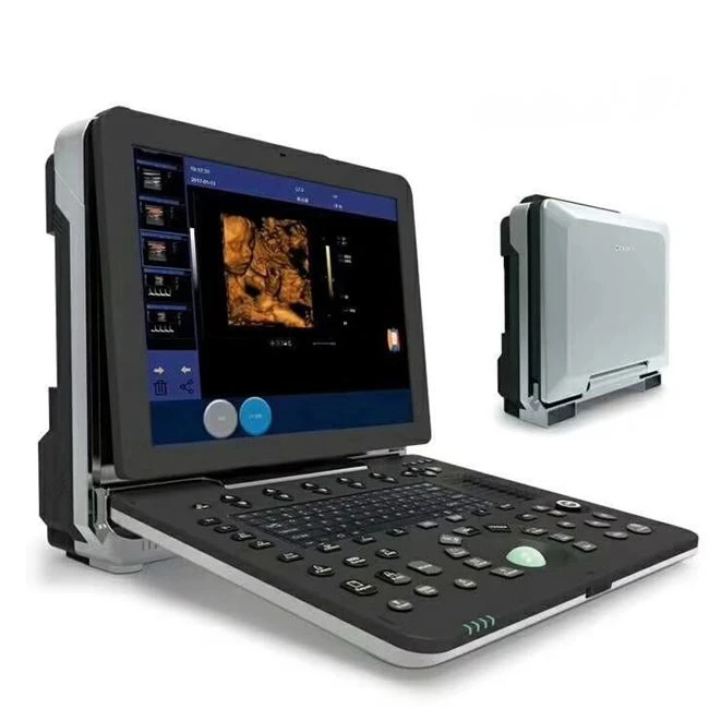 Color Doppler Ultrasound Color Doppler Ultrasound
