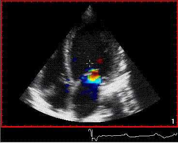 _20211202152102 _20211202152102