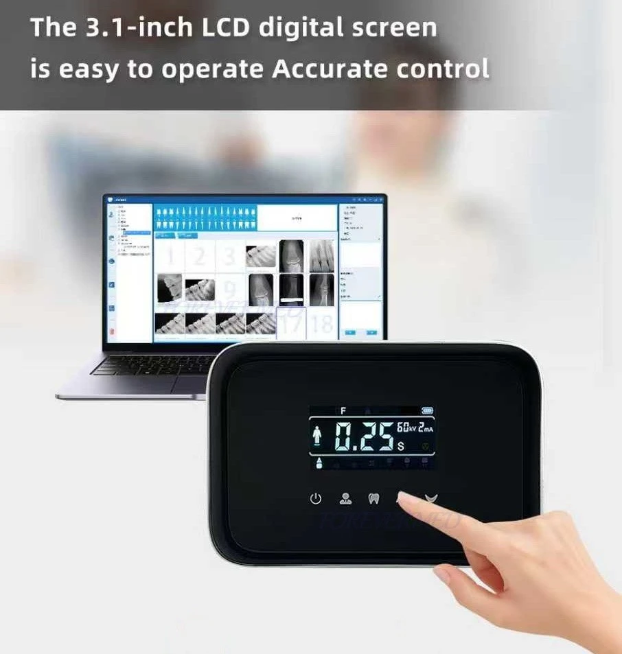 3.1 Inch Dental X Ray Device high quality