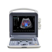Tragbarer 3D/4D-Farbdoppler-Scanner