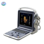 YJ-U60PLUS Farbdoppler ——Volldigitales Farbdoppler-Ultraschall-Diagnosesystem
