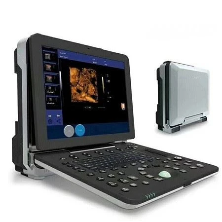 YJ-C90 High-end USG Color Doppler Portable Ultrasound For Hospital And Clinic YJ-C90 High-end USG Color Doppler Portable Ultrasound For Hospital And Clinic