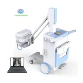 Mobiles digitales Hochfrequenz-Röntgengerät DR X Ray System
