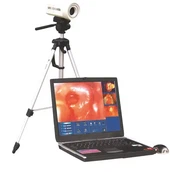 Spezialisiertes digitales optisches Kolposkop von Sony Medical Hospital