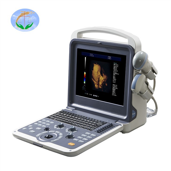 4D Color Doppler Full Digital Color Doppler Ultrasound Diagnostic System 4D Color Doppler Full Digital Color Doppler Ultrasound Diagnostic System