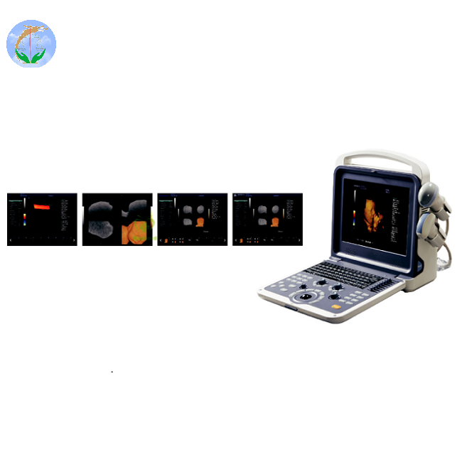 4D Color Doppler Full Digital Color Doppler Ultrasound Diagnostic System 4D Color Doppler Full Digital Color Doppler Ultrasound Diagnostic System